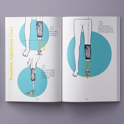 Student's DIY design project empowers people to make their own prostheses