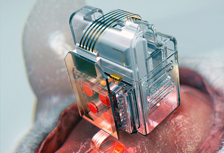 Soft neural implant