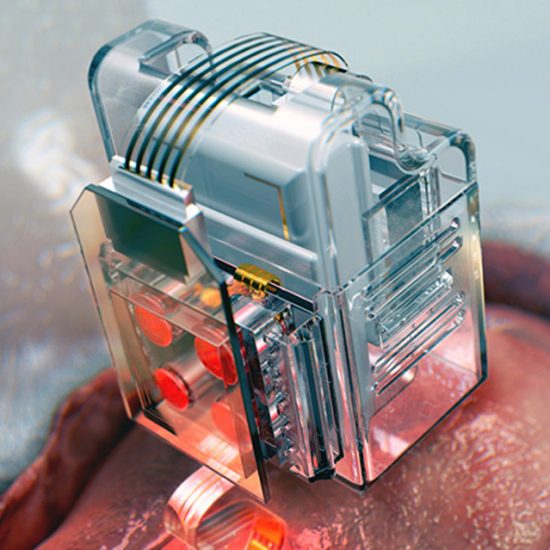 Soft neural implant