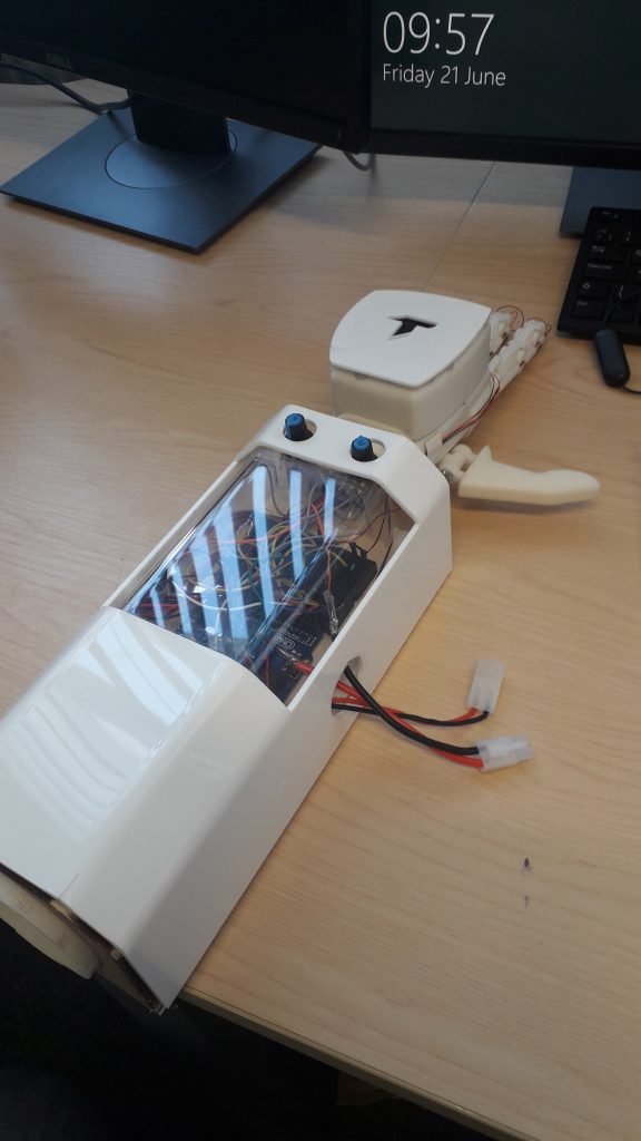 Lorenzo Spreafico's 3D-printed prosthetic gives tactile feedback at low cost