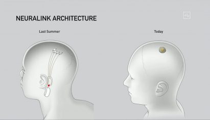 Elon Musk unveils new Neuralink brain implant design and robot that inserts it