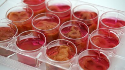 Human cells being grown on mycelium scaffolds and in human serum to create the Ouroboros Steak