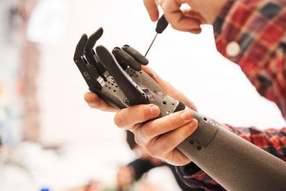 A prosthetic arm being screwed together