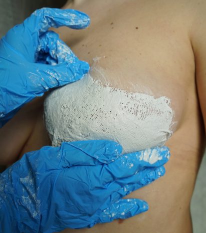 Person taking a cast of someone's breast
