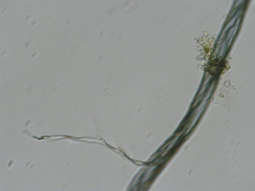 A magnified close up of bioplastic