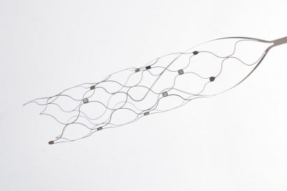 Synchron stent-like implant