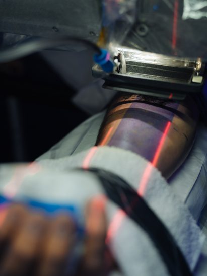 Black's AI powered tattoo device