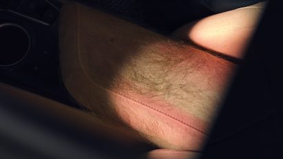 Close-up photo of a hairy component with the Sunburnt Car